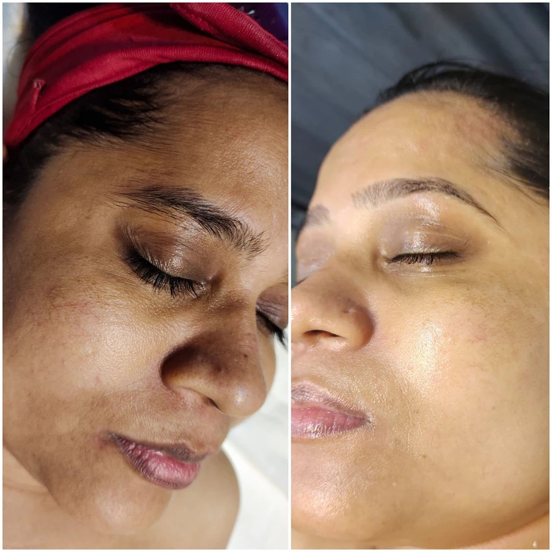 (🔥LAST DAY SALE-80% OFF)Fast Anti-Aging and Whitening with AQA™ Facial Repair Essence