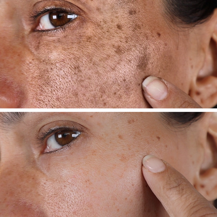 (🔥LAST DAY SALE-80% OFF)Fast Anti-Aging and Whitening with AQA™ Facial Repair Essence