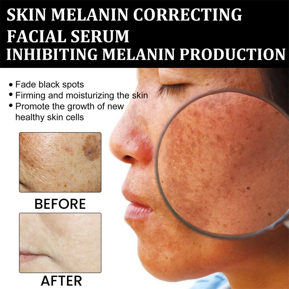 (🔥LAST DAY SALE-80% OFF)Fast Anti-Aging and Whitening with AQA™ Facial Repair Essence