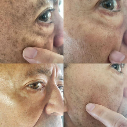 （🔥LAST DAY SALE-80% OFF)Fast Anti-Aging and Whitening with AQA™ Facial Repair Essence