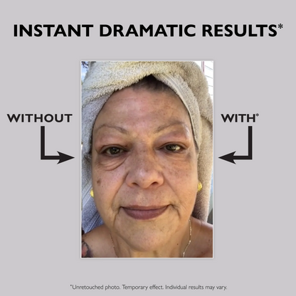 ✨[Official Brand Store] Instant Eye Temporary Eye Tightener (🔥time-limited offer)