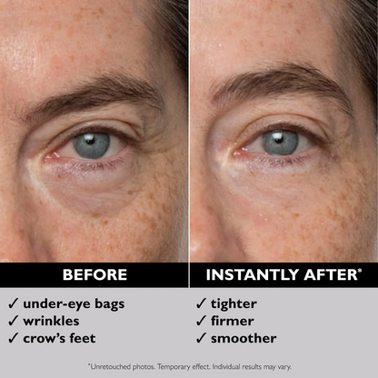 ✨[Official Brand Store] Instant Eye Temporary Eye Tightener (🔥time-limited offer)