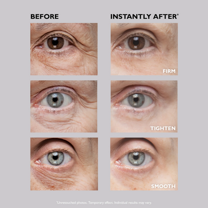 ✨[Official Brand Store] Instant Eye Temporary Eye Tightener (🔥time-limited offer)